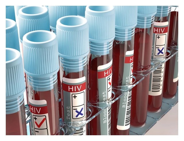 National HIV Estimates: 15,290 new infections recorded in 2024